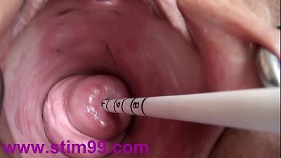 extreme Real Cervix ravaging insertion korean Sounds and Objects in Uterus